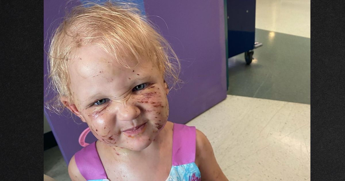 Family's Four Puppies Maul 2-Year-Old Girl while 'Playing,' Eat Half Her Ear