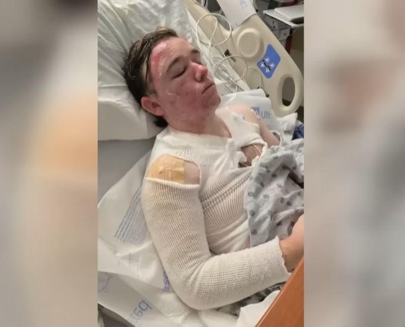 Worker Burned by Boiling Oil in Shocking Fast-Food Attack